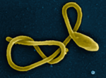 Ebola Virus