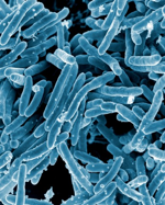 Scanning Electron Microscope image of Tuberculosis bacterium