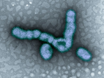 Transmission electron microscope image of the flu virus